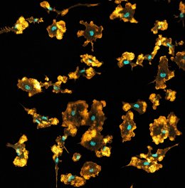 Archivo - Arquivo - Macrófagos de camundongo visualizados em uma imagem de microscópio confocal. Os núcleos são mostrados em azul e a rede de actina em laranja.
