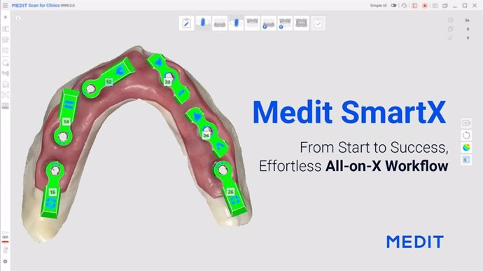 Medit SmartX