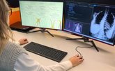 Foto: El IBV aplica la Inteligencia Artificial para mejorar el diagnóstico de la escoliosis