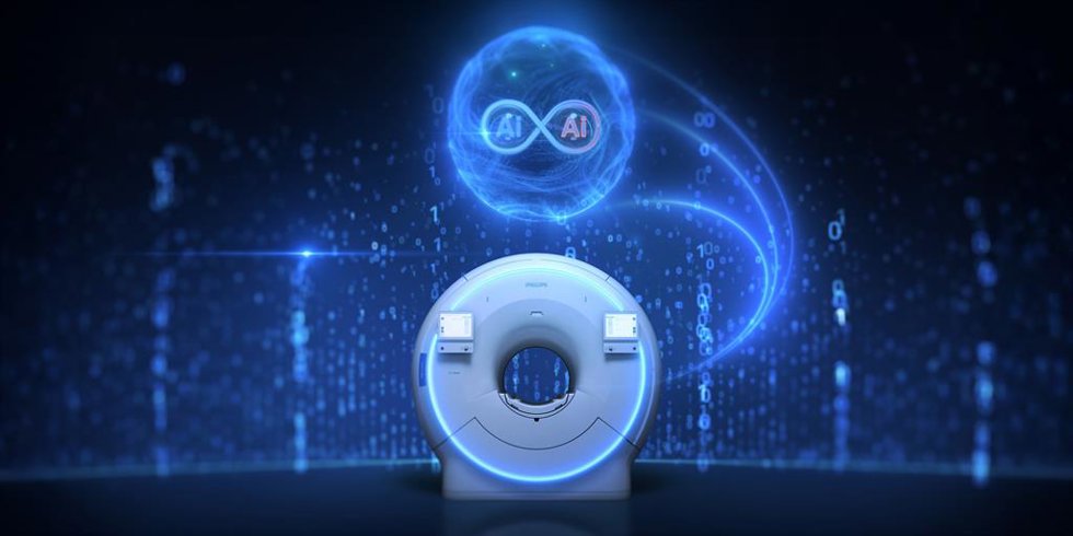 La última tecnología SmartSpeed Precise MRI