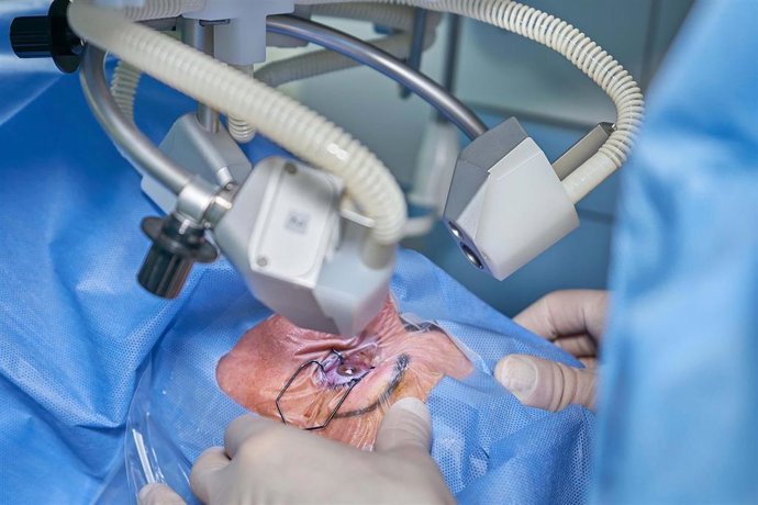 Archivo - Una paciente se somete a una operación de cataratas.