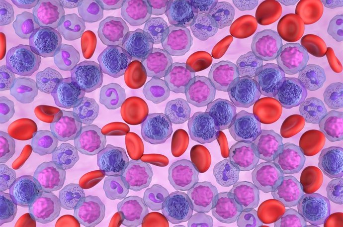 Archivo - Arquivo - Leucemia mieloide aguda
