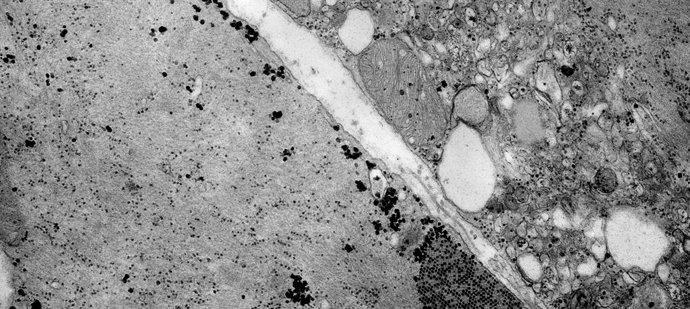 Archivo - Arquivo - Imagem de microscópio de um enterovírus da família Coxsaquievirus