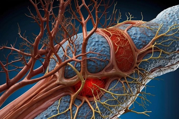 Pesquisa no Instituto de Biomedicina propõe um tratamento personalizado para o melanoma uveal.