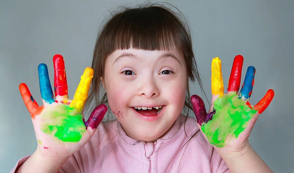 Imagen de una niña con Síndrome de Down.