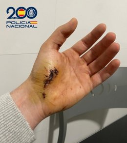 Um policial de Melilla é agredido e recebe onze pontos em uma das mãos ao reduzir o agressor de uma mulher no meio da rua em Málaga, enquanto estava em trajes civis.