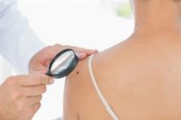 Descubren cómo el melanoma y otros tumores se ocultan para eludir la inmunoterapia