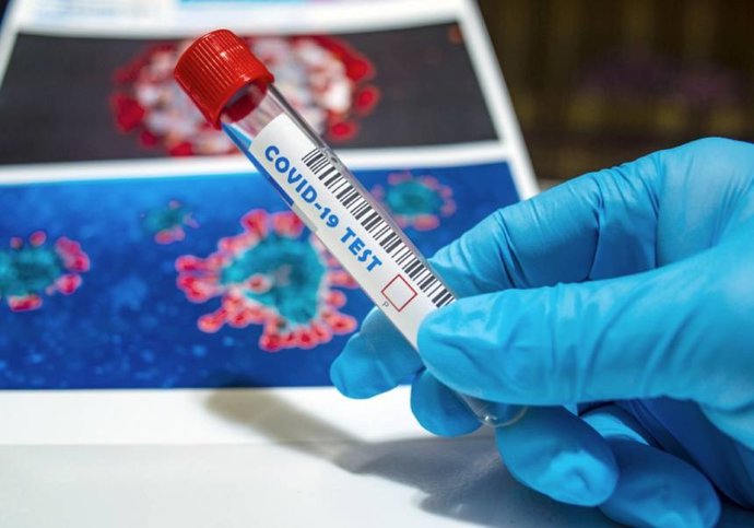 Covid en base de datos