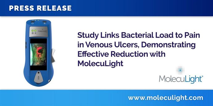 Study Links Bacterial Load to Pain in Venous Ulcers, Demonstrating Effective Reduction with MolecuLight