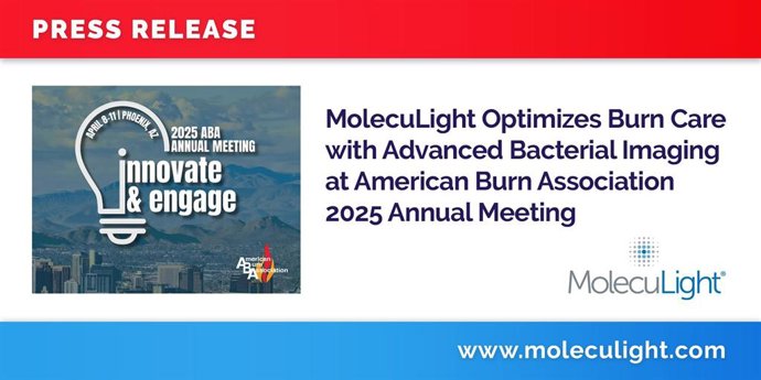 MolecuLight_MolecuLight_Optimizes_Burn_Care_with_Advanced_Bacter
