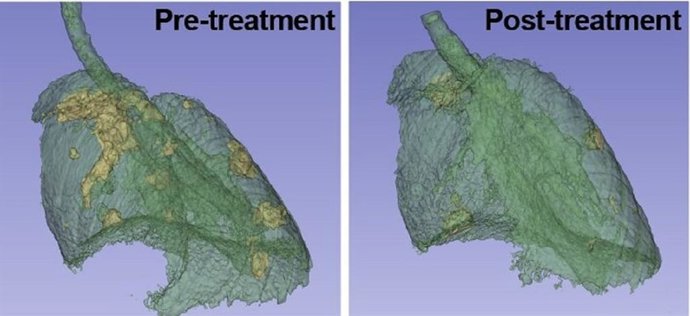 Imagem do pulmão do camundongo com focos de tumor (amarelo), antes e depois do tratamento.