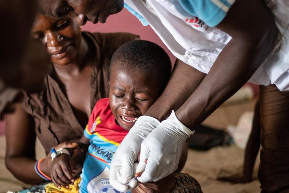 Archivo - Un niño recibe tratamiento contra el sarampión en RDC