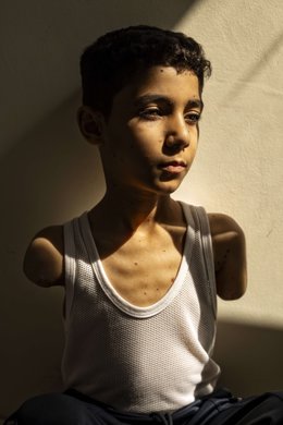 Mahmoud, un xiquet de Gaza mutilat, foto de l'any del World Press Photo.