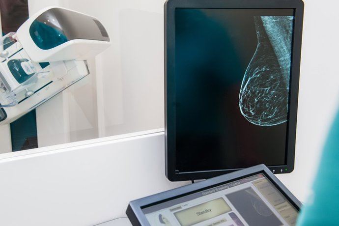 Archivo - Arquivo - Imagem de uma mamografia para rastreamento de câncer de mama