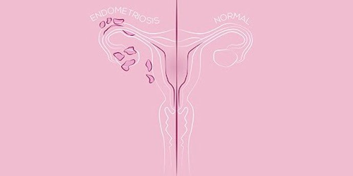 Archivo - Foto de archivo