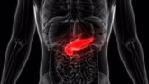 Foto: Descubren un nuevo fármaco que podría cambiar el tratamiento del cáncer de páncreas para siempre