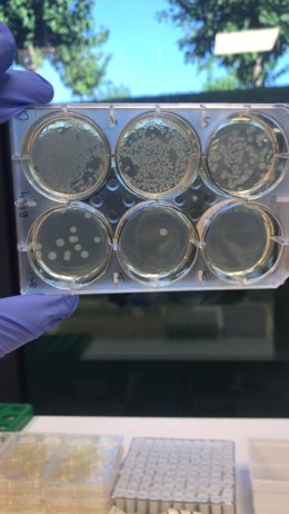 Archivo - Cultivos de Pseudomonas aeruginosa extremadamente resistente