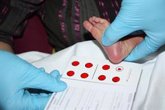 Foto: FEDER alerta de la inequidad por CCAA en el acceso a las pruebas para detectar enfermedades en los recién nacidos