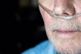 Foto: Más de 24.000 firmas piden protocolos para garantizar la supervivencia de personas electrodependientes en caso de apagón