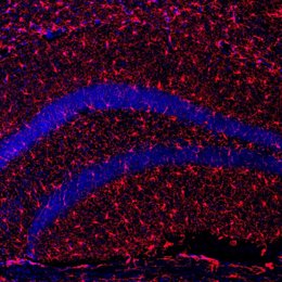 Imagen con microscopía de células microgliales (parte del sistema inmune del cerebro, en rojo) del hipocampo de los ratones tratados con s-KL.