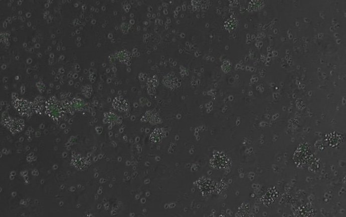 Celulas con el gen de fluorescencia activado por el elemento regulador diseñado por IA.