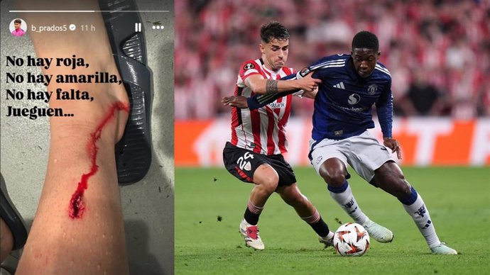 Beñat Prados sufre una herida inciso-contusa y es duda ante el Alavés.