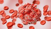 Foto: El Acuerdo Marco para el suministro de medicamentos de Factor VIII de coagulación recombinante ahorrará 8 millones