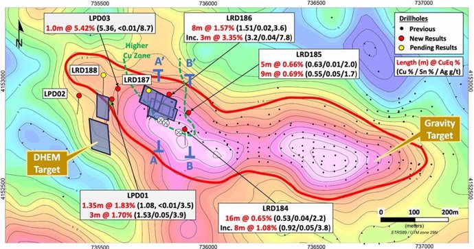 Figure 1 - La Romana gravity anomaly map showing locations of new drillholes LRD184 to LRD188, and LPD01 to LPD03, and cross-section locations A-A’ (Figure 2) and B-B’ (Figure 3)