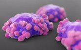 Foto: La UE aprueba 'Calquence' más quimioinmunoterapia para tratar el linfoma de células del manto