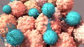 Foto: Terapia CAR-T: Un avance en cáncer, pero causa 'niebla mental' que podría corregirse con nuevos tratamientos