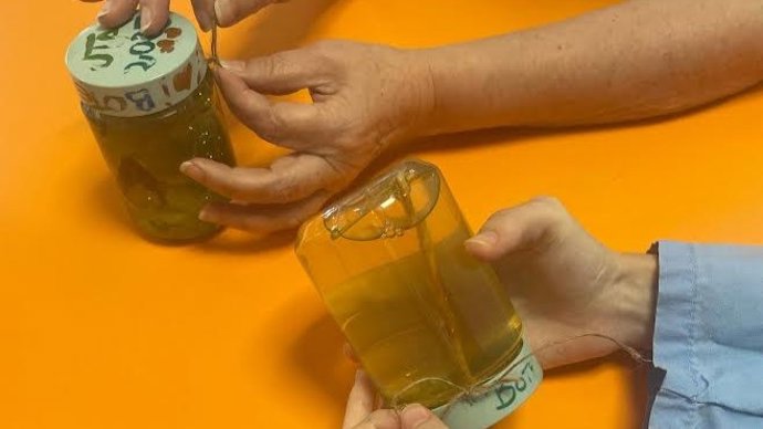 El Hospital Sant Joan d'Alacant analiza el impacto de los talleres de enfermería en los pacientes con anorexia y bulimia