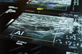Foto: La biopsia líquida, alternativa eficaz para detectar mutaciones en cáncer de mama HER2+