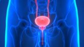 Foto: Radioterapia exprés: SBRT es tan segura como la convencional tras cirugía de próstata, según estudio de UCLA