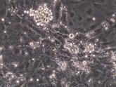 Foto: Un estudio identifica 7 genes para producir de forma fiable precursores de células sanguíneas