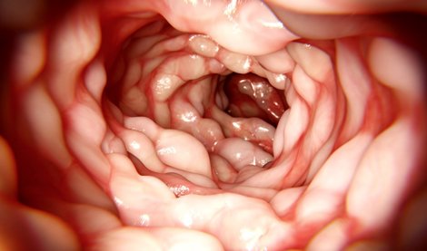 Nutrición