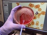 Foto: Validan una combinación terapéutica contra una bacteria habitual y resistente a antibióticos