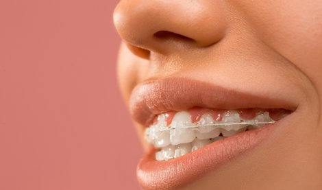 Estética