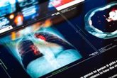 Foto: Un pionero programa permite a oncólogos de referencia internacional formar a nuevos investigadores en cáncer de pulmón