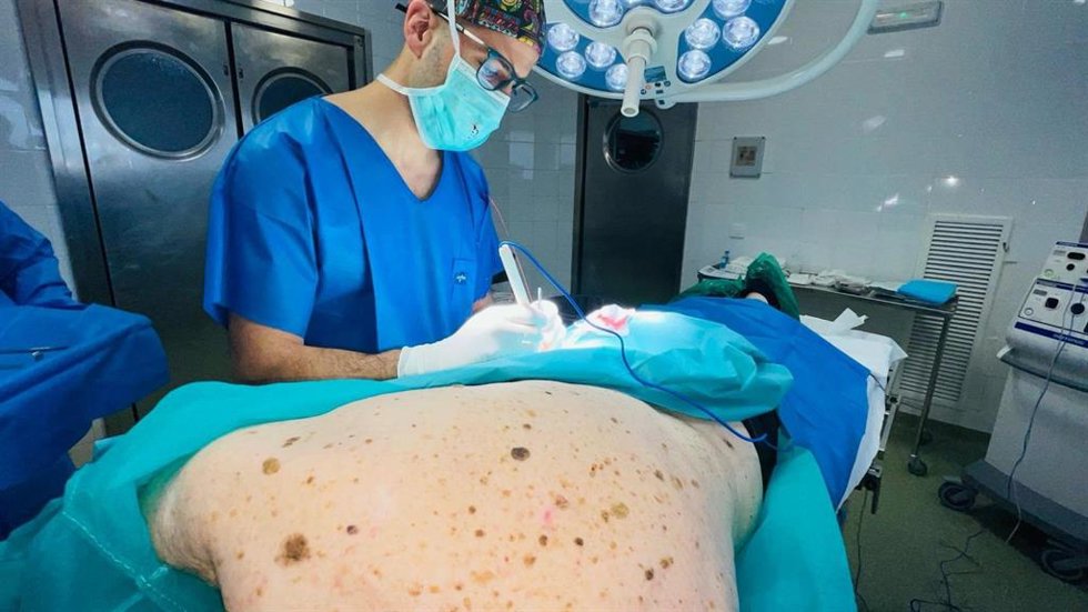 Intervención quirúrgica en el Hospital Virgen Macarena de Sevilla de un melanoma