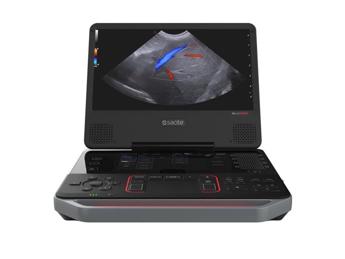 The new MyLabHeron ultrasound scanner