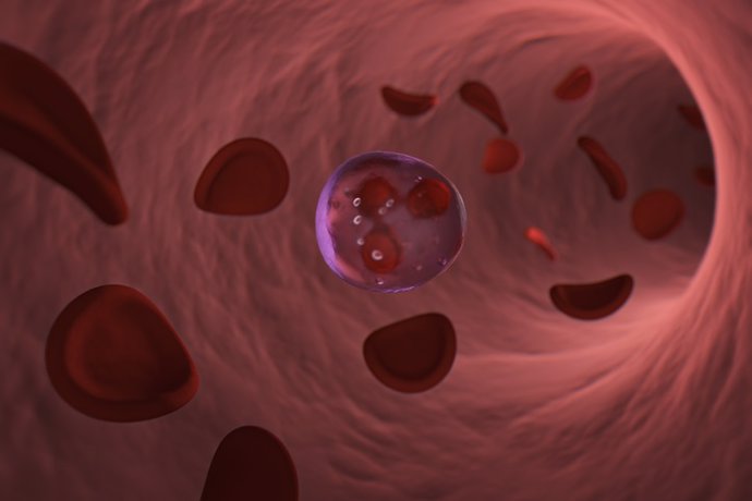 Archivo - Imagen de recurso de una representación de leucemia.