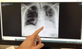 Foto: Expertos alertan que el tabaquismo sigue siendo la mayor amenaza a la salud, liderando el ranking de muertes evitables