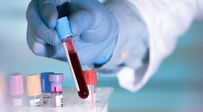 Archivo - Arquivo - Um simples exame de sangue é suficiente para detectar positividade para