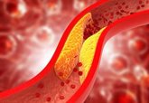 Foto: La Sociedad Española de Arteriosclerosis supera las 100 Unidades de Lípidos homologadas