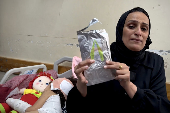 31 de maio de 2025, Khan Younis, Faixa de Gaza, Território Palestino: A menina palestina Mira Ahmad, de três anos de idade, está recebendo cuidados médicos no Nasser Medical Hospital, em Khan Younis, depois de sofrer vários ferimentos de estilhaços no cér