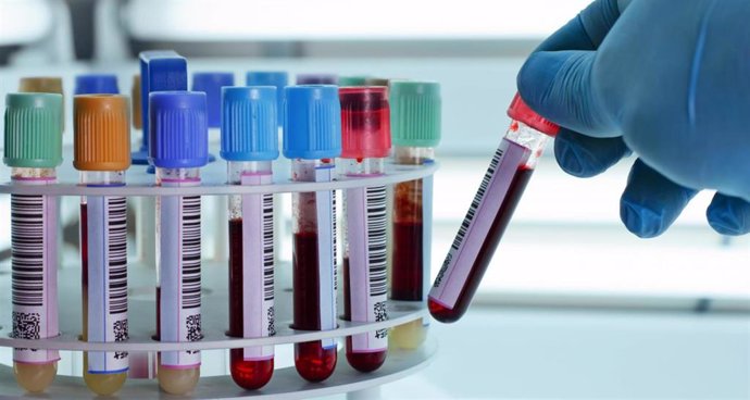Archivo - Imagen de recurso de un laboratorio clínico.