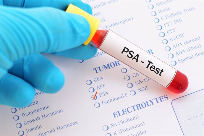 Archivo - Imagen de recurso de una prueba PSA para cáncer de próstata.