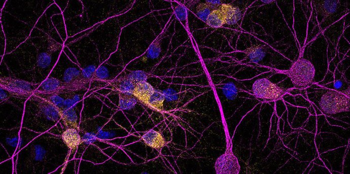 Imunofluorescência de neurônios em cultura; proteína PKD1 em amarelo.