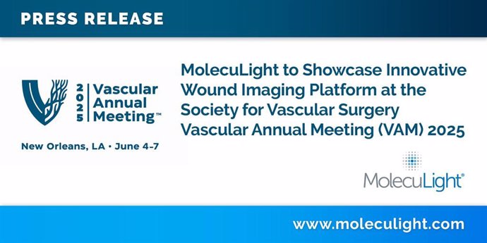 MolecuLight to Showcase Innovative Wound Imaging Platform at the Society for Vascular Surgery Vascular Annual Meeting