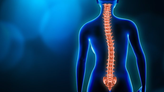 Archivo - Curvatura de la columna vertebral y la mujer cuerpo vista posterior 3D ilustración de representación con espacio de copia. Trastorno de la columna vertebral, escoliosis, lesión en la columna vertebral, anatomía humana y conceptos médicos.